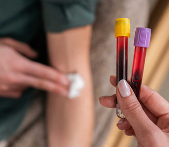 LDL, ApoB, HDL, Cholesterin – der Guide zum Thema Blutfettwerte